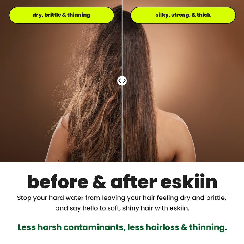 Eskiin Filtered Showerhead With Filters For Healthy Hair & Skin